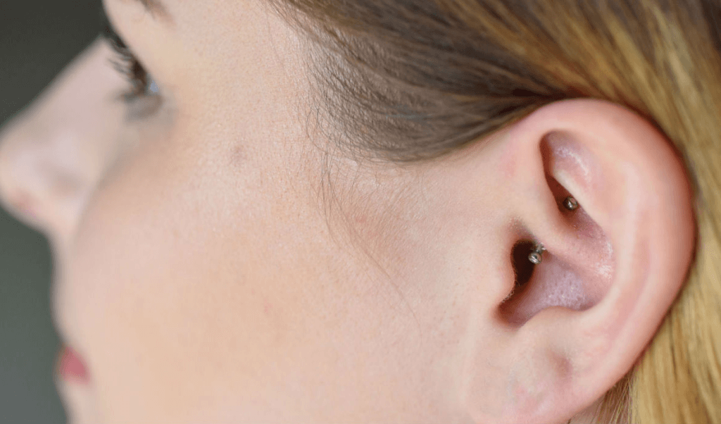 daith piercing for anxiety